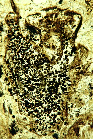 Sporangium met sporen van Horneophyton