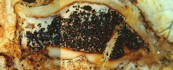 Sporangium van Horneophyton