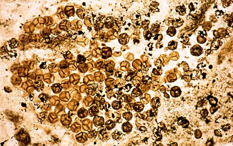 Spores of Horneophyton