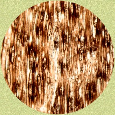 Conifer wood: tangential section 100 x