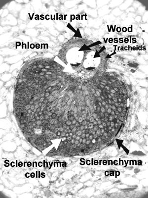 Vascular bundle of palm wood