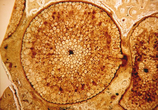 Transverse section of an axis of Rhynia