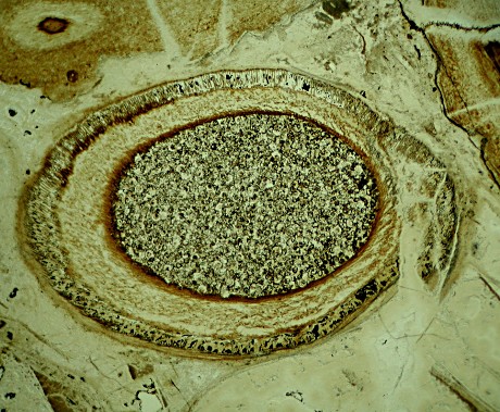 Sporangium van Aglaophyton