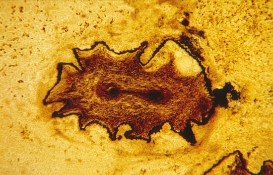 Decayed stem of Rhynia