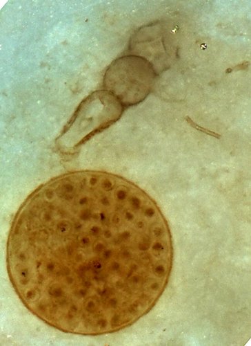 Rotifer and alga