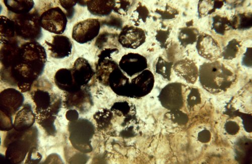 Tetrad of spores